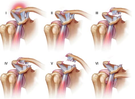 Dr Jorge Enrique Mar N Ni O Ortopedista Hombro Y Rodilla