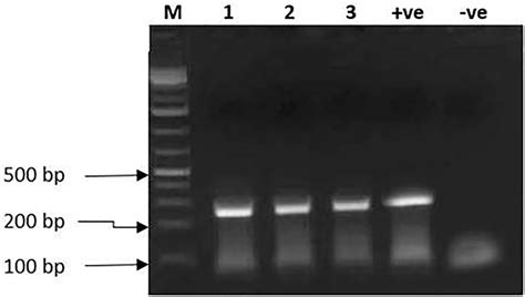 Gel Electrophoresis Result Showing DNA Fragments Of 278 Bp Produced