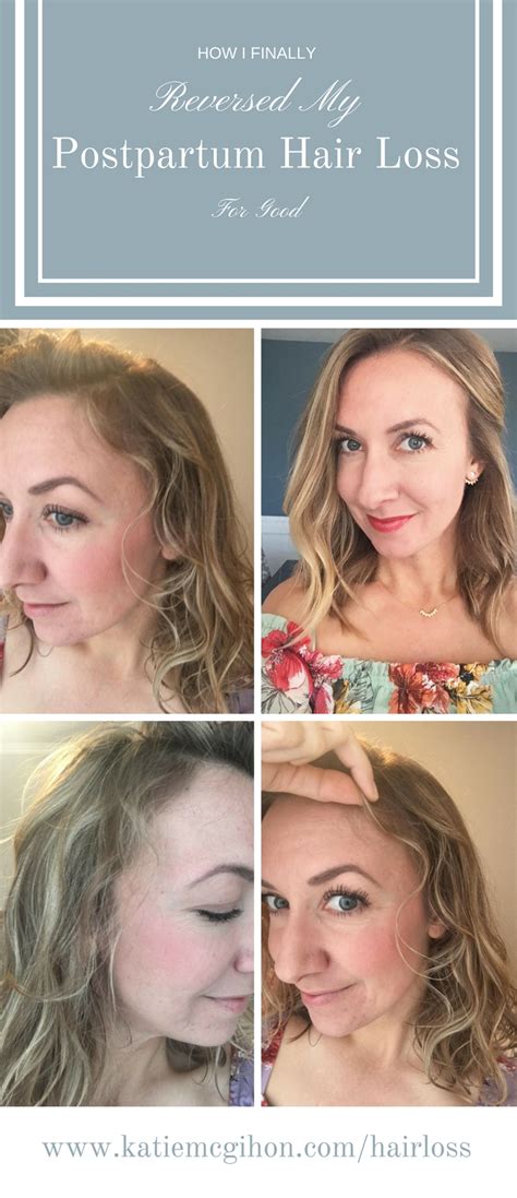 How I Finally Reversed My Postpartum Hair Loss Katie Mcgihon Photography