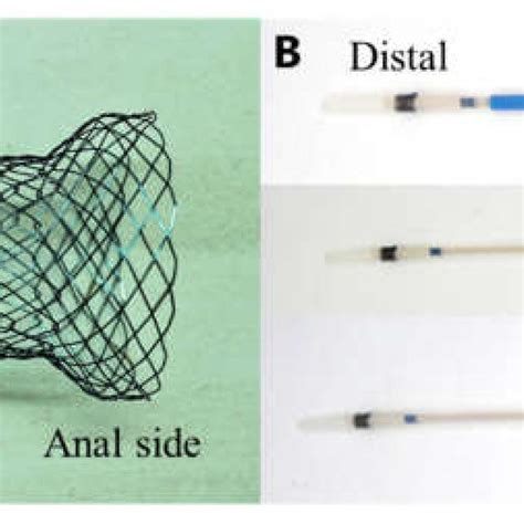 The Newly Developed Proximal Release Type Colonic Stent A The