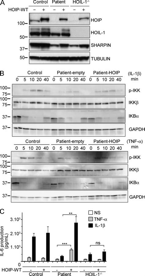 Complementation of impaired NF κB activation by reintroduction of the