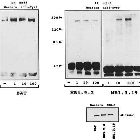 Tyrosine Phosphorylation Induced By Insulin In Primary Immortalized