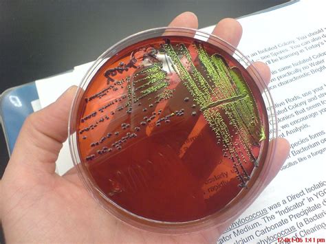 E Coli Plate