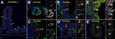 Dcamkl 1 Expression Identifies Tuft Cells Rather Than Stem Cells In The