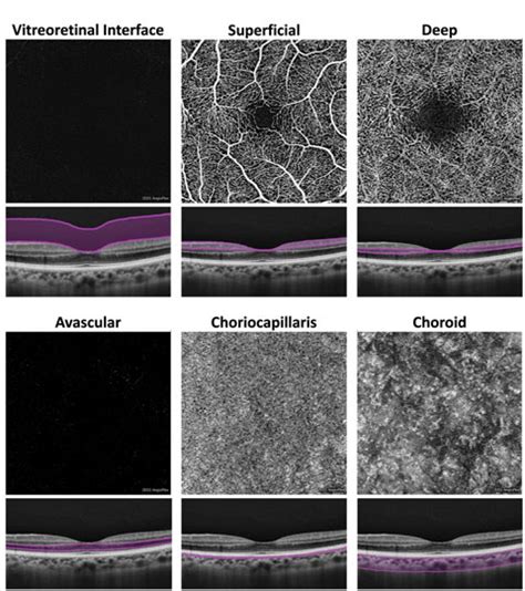 Imaging Motion A Review Of Oct A