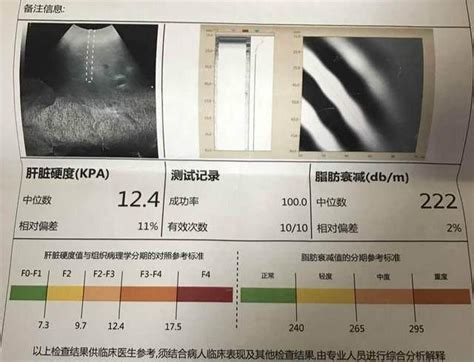 肝脏的测量及正常值图肝大小测量示意图肝超声测量示意图大山谷图库