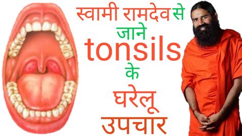 Ayurvedic Treatment And Home Remedies For Tonsil By Baba Ramdev Swami