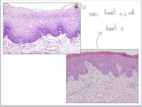 Histology Epithelium P1 Flashcards Quizlet