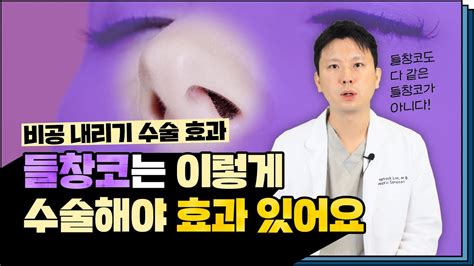 다 같은 비공내리기가 아닙니다 유형에 따른 실제 사례를 확인해보세요 Ft 마인드성형외과 이영택 원장님 Youtube