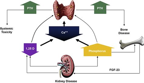 Overview Of The Kdigo Ckd Mbd Update Practice Implications For