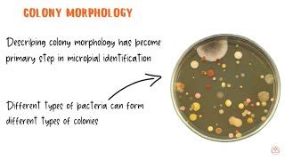 Bacterial Colony Description | Doovi