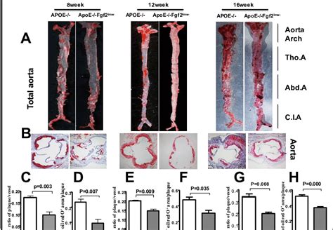 Effects Of Knockout Kda Fgf On Aortic Atherosclerotic Plaque Growth