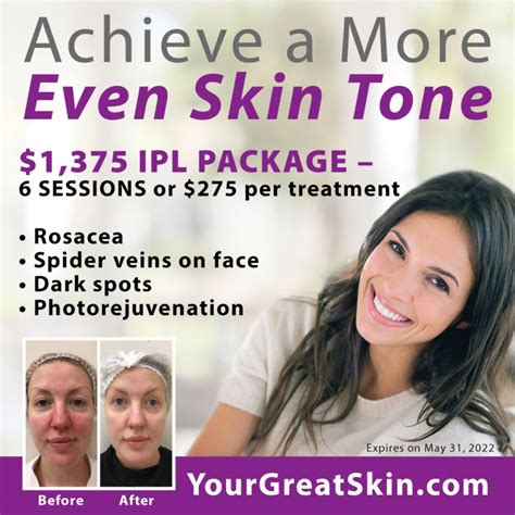 Special Pricing On Ipl Laser Treatments Your Great Skin