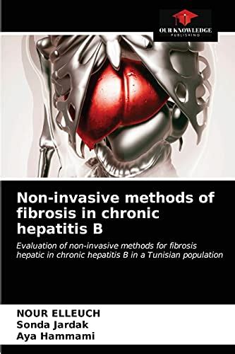 Non Invasive Methods Of Fibrosis In Chronic Hepatitis B Evaluation Of