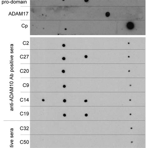 Immunofluorescence Reactivity Of Igg From Patient Sera On Lovo Cell