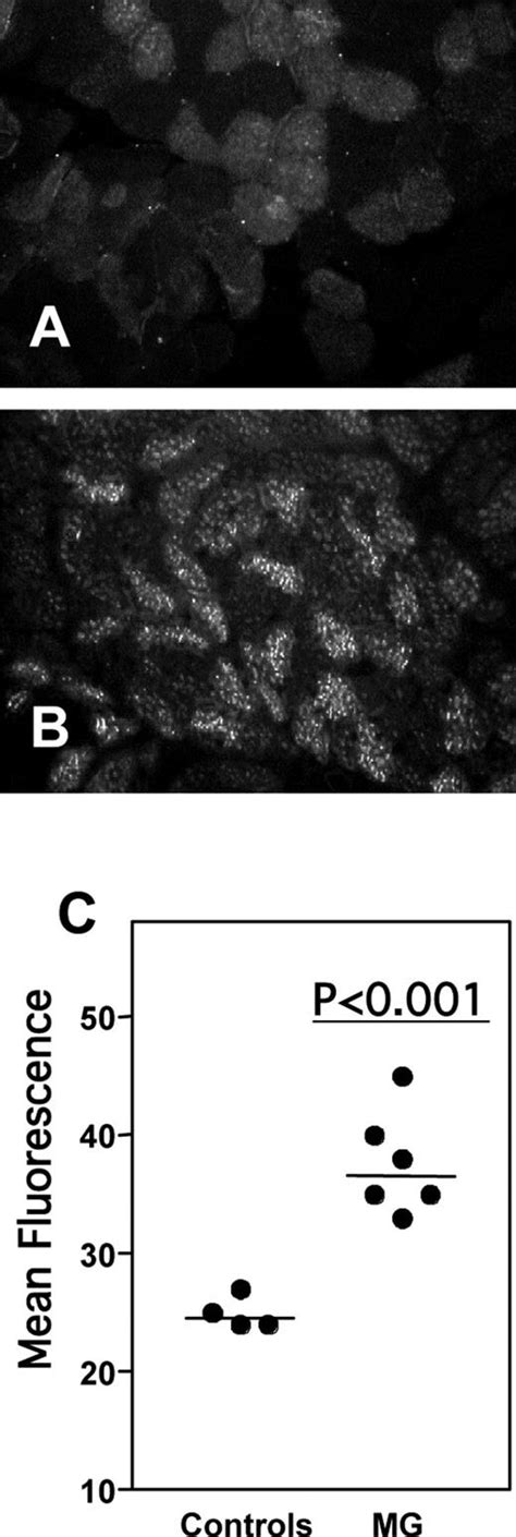 Overexpression Of Ifn Induced Protein 10 And Its Receptor Cxcr3 In