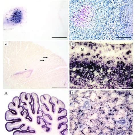 PrP Sc Distribution In The Brain Of Atypical Nor98 Scrapie Brain