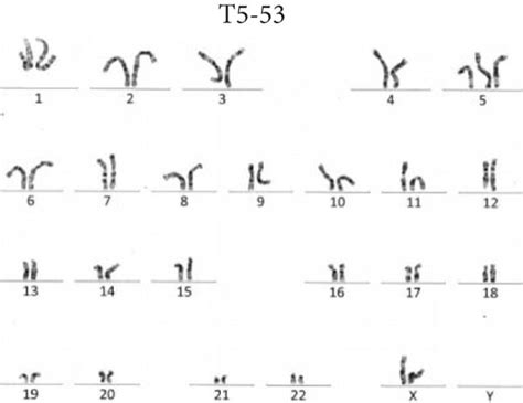 Cytogenetic Characterization Of Distinct Human MSC Populations After Ex