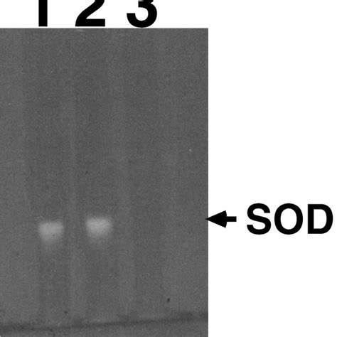 Analysis Of Superoxide Dismutase Activity Lane 1 R1 Wild Type Lane