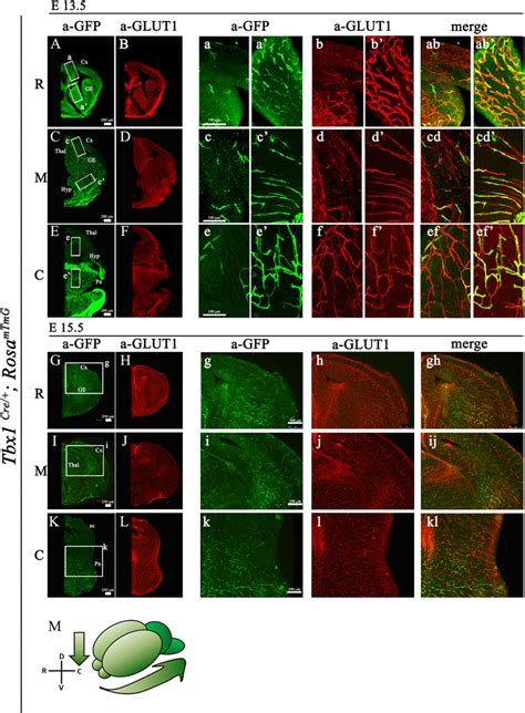 Distribution Of Tbx Fated Cells In The Brain Of Tbx Cre Rosa Mtmg