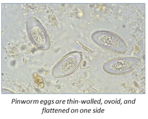 GI Nematodes Flashcards Quizlet