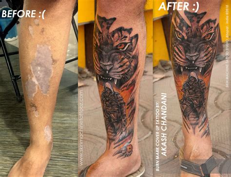 Details More Than Burned Skin Tattoo In Coedo Vn