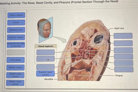 [answered] Labeling Activity The Nose Nasal Cavity And Pharynx Frontal