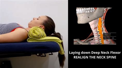 Laying Down Deep Neck Flexor — Sydney Health Physiotherapy