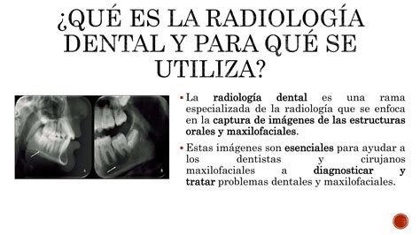 Grupo Radiolog A Bucal Y Maxilofacial Pptx