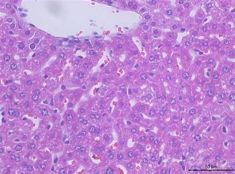 请教小鼠肝脏病理切片怎么看 丁香园论坛