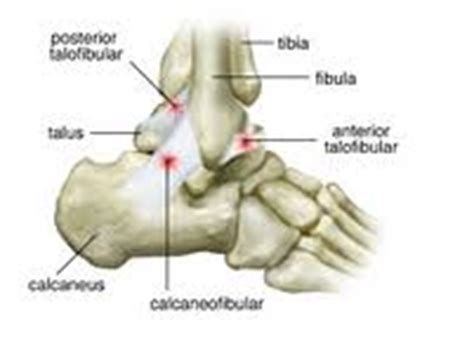 MOI|Signs|Symptoms - Inversion Ankle Sprain