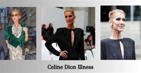 Celine Dion Illness: How It Affected Her Career And Personal Life ...