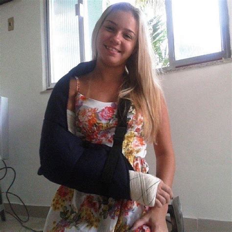 pin  arm cast arm cast  cast arms