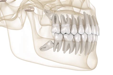 impacted tooth elite oral  facial surgery long island