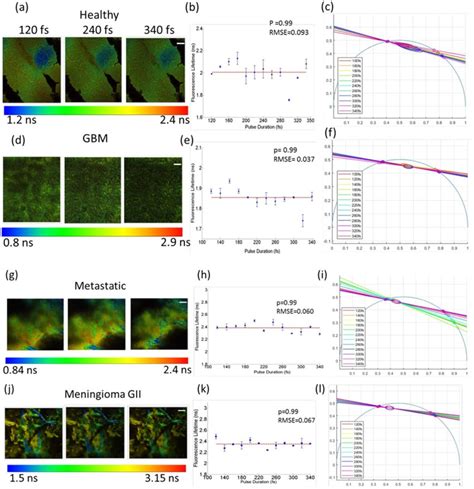 Flim Analysis Adgj Represent Fluorescence Lifetime Images