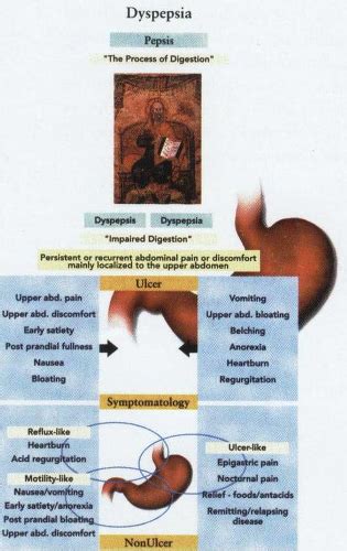 Dyspepsia | Basicmedical Key