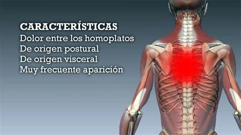 M Sculos Intercostales Definici N Funci N Origen E Inserci N Y M S