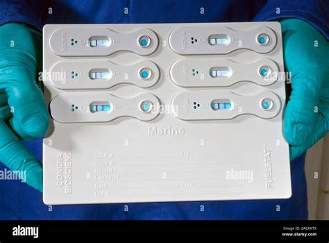 Fuel microbial contamination test. Researcher carrying out a test for ...