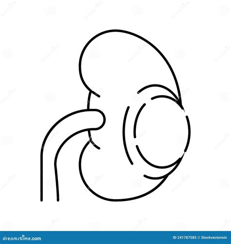 Renal Cyst Bosniak Type A Complex Cyst Of The Kidney Renal Cell