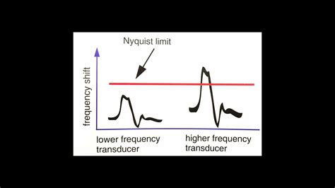 Aliasing Ultrasound Physics Youtube