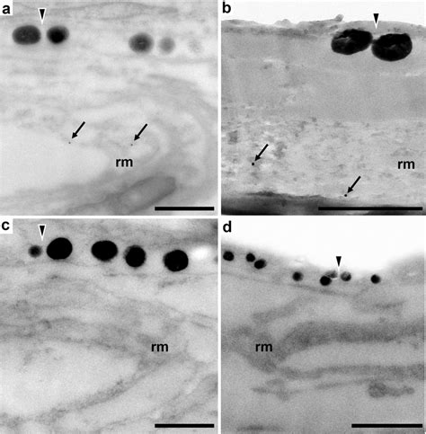 Sws1 Immunogold Transmission Electron Micrographs Of Skin Cross