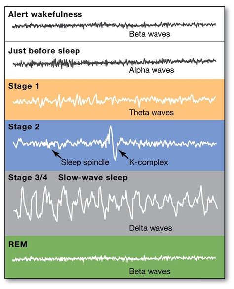 Brain Waves Diagram | Quizlet