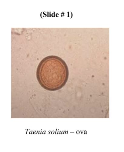 Parasite Pictures Flashcards Quizlet