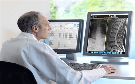 Workstations Agfa Radiology Solutions