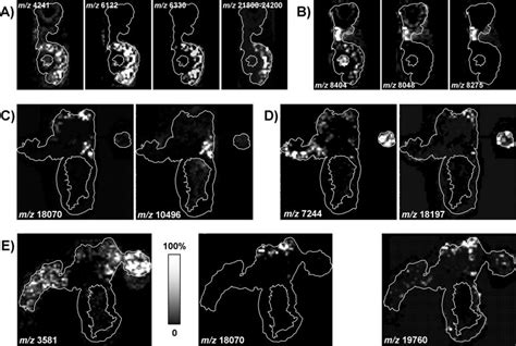 Identification Of Cd 1 Prostatic Lobe Specific Proteins By Imaging Ms Download Scientific