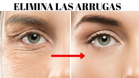 Elimina Las Arrugas Y Rejuvenece El Rostro Youtube