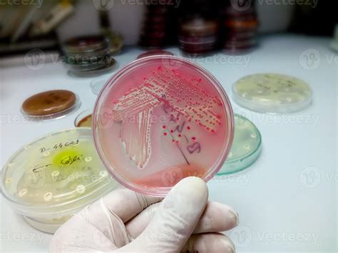 Colonias De Bacterias En Agar Macconkey Placa De Medio De Cultivo