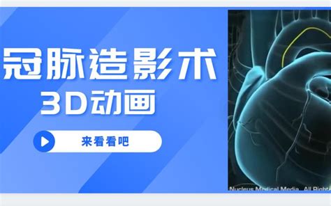 3d冠脉造影术哔哩哔哩bilibili