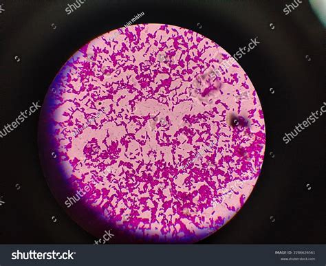 Staphylococcus Epidermidis 100x