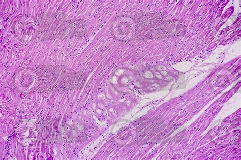 Mammal Heart Fiber Of Purkinje Transverse Section X Fibers Of